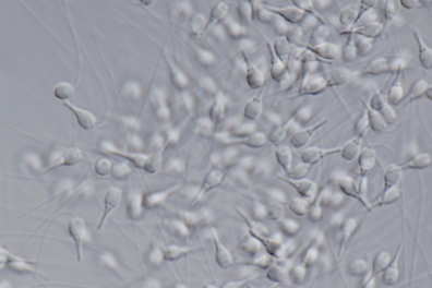 Moule (Mytilus edulis) - Spermatozoïdes x400